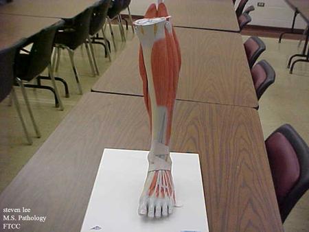 Steven lee M.S. Pathology FTCC. Tibialis anterior gastrocnemius soleus Flexor digitorum longus Extensor digitorum longus Peroneus longus Lateral malleolus.