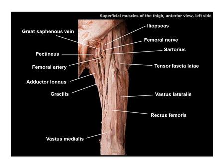 Iliopsoas Great saphenous vein Femoral nerve Sartorius Pectineus