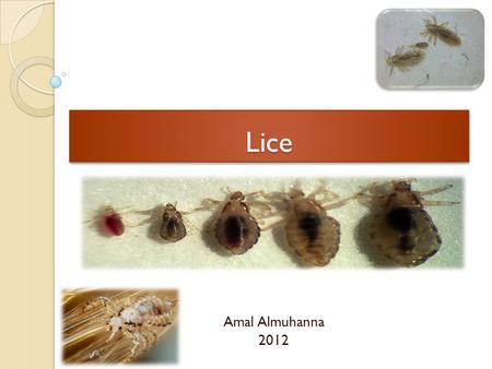 Lice Amal Almuhanna 2012.