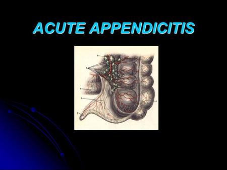 ACUTE APPENDICITIS.