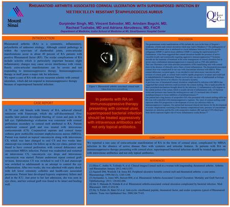 In patients with RA on immunosuppressive therapy presenting with corneal ulcer, superimposed bacterial infection should be treated aggressively with intravenous.