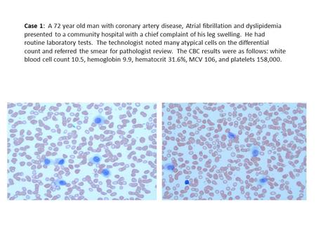 Case 1: A 72 year old man with coronary artery disease, Atrial fibrillation and dyslipidemia presented to a community hospital with a chief complaint of.