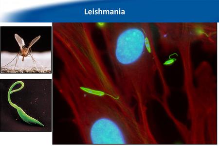 We work with the protozoan parasite Leishmania… Leishmania.