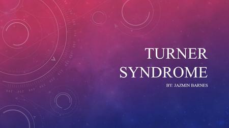 TURNER sYNDROME By: Jazmin Barnes.