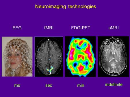 Neuroimaging technologies EEGfMRIFDG-PETaMRI mssecmin indefinite.