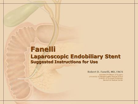 Fanelli Laparoscopic Endobiliary Stent Suggested Instructions for Use