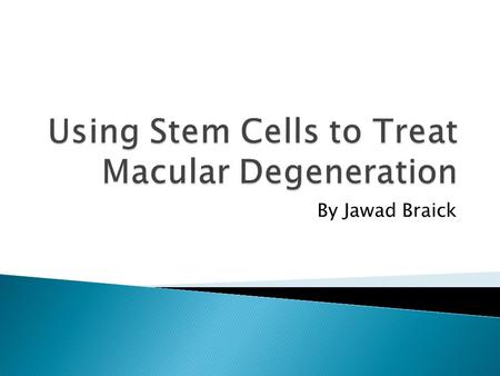 By Jawad Braick.  Macular degeneration is progressive loss of vision to the point of legal blindness due to damage to the macula, the part of the eye.