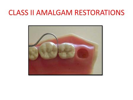 CLASS II AMALGAM RESTORATIONS