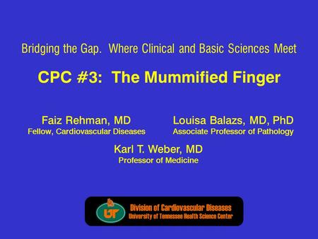 CPC #3: The Mummified Finger