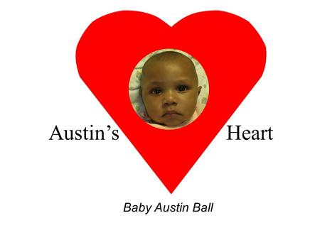 Austin’s Heart Baby Austin Ball MEET AUSTIN At 28 weeks gestation a huge tumor was found in Austin’s heart. It is called a left ventricular mass. The.