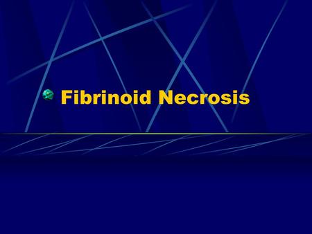 Fibrinoid Necrosis. Fibrinoid necrosis So called “ fibrinoid degeneration ” in old textbooks of pathology It appears as strongly eosinophilic, reflexible.