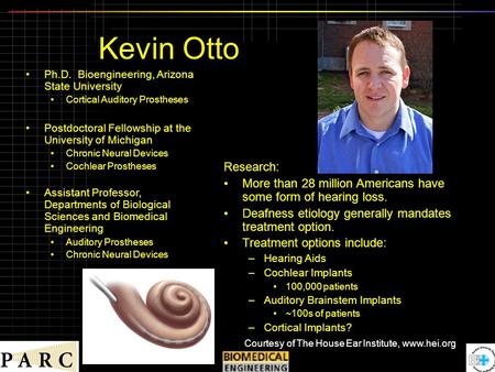 Kevin Otto Research: More than 28 million Americans have some form of hearing loss. Deafness etiology generally mandates treatment option. Treatment options.