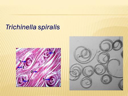 Trichinella spiralis.