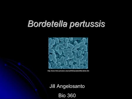 Bordetella pertussis  Jill Angelosanto Bio 360.