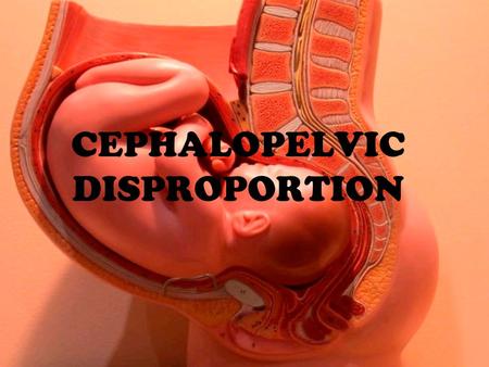 CEPHALOPELVIC DISPROPORTION. Implies disproportion between the head of the baby (cephalus) and the mother’s pelvis Complications can occur if the fetal.