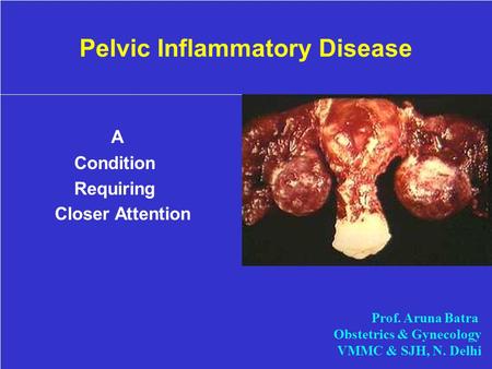 Pelvic Inflammatory Disease