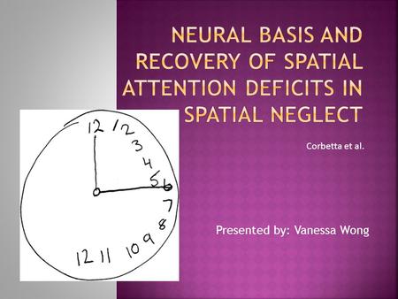 Presented by: Vanessa Wong Corbetta et al..  Inability to pay attention to space  Most common cause is stroke  Caused by focal injury to temporoparietal.