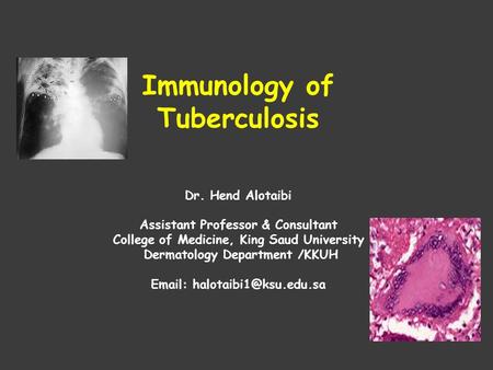 Immunology of Tuberculosis