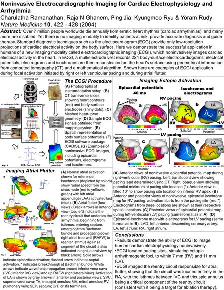 Noninvasive Electrocardiographic Imaging for Cardiac Electrophysiology and Arrhythmia Charulatha Ramanathan, Raja N Ghanem, Ping Jia, Kyungmoo Ryu & Yoram.