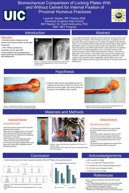 Hypothesis Figure 1: Proximal end of human humerus bone fitted with the 3.5mm Proximal Humerus Plate before testing. Figure 2: Proximal end of human humerus.