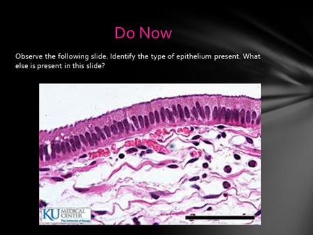 Do Now Observe the following slide. Identify the type of epithelium present. What else is present in this slide?