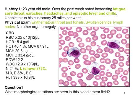 History 1: 23 year old male. Over the past week noted increasing fatigue, sore throat, earaches, headaches, and episodic fever and chills. Unable to run.