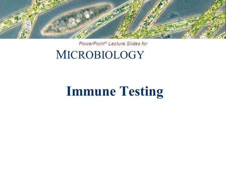 Immune Testing.