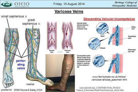 vascularweb.org/_CONTRIBUTION_PAGES/