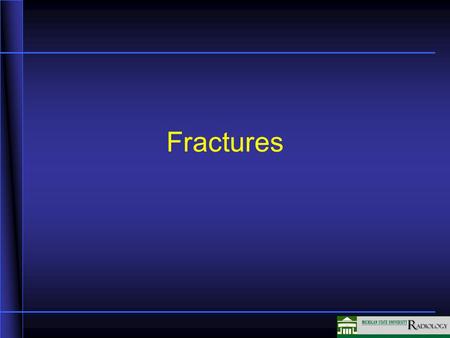 Fractures In this unit we will be discussing fractures.