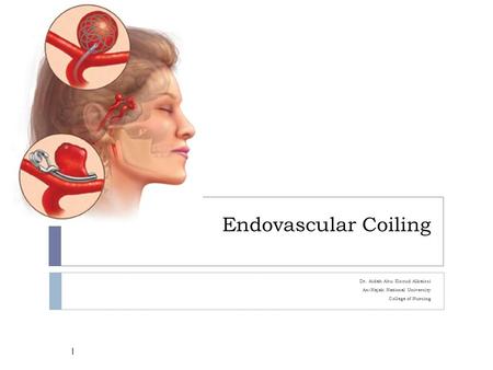 Endovascular Coiling Dr. Aidah Abu Elsoud Alkaissi