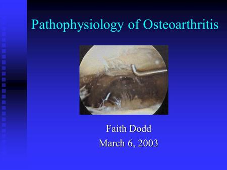 Pathophysiology of Osteoarthritis