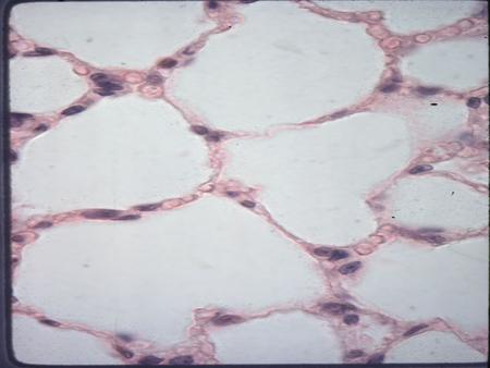 Simple Squamous Location: lungs Simple Cuboidal Location: renal tubules.