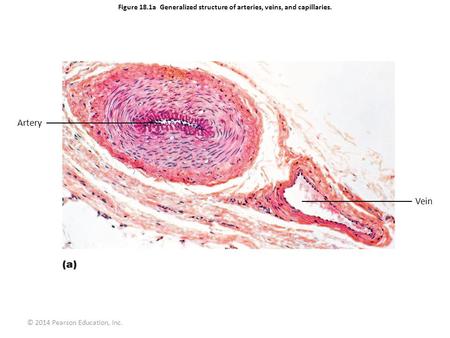 Figure 18.1a Generalized structure of arteries, veins, and capillaries. Artery Vein © 2014 Pearson Education, Inc.