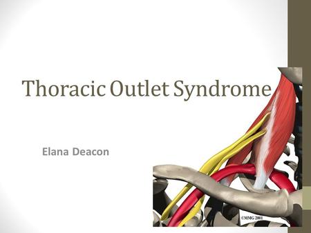 Thoracic Outlet Syndrome