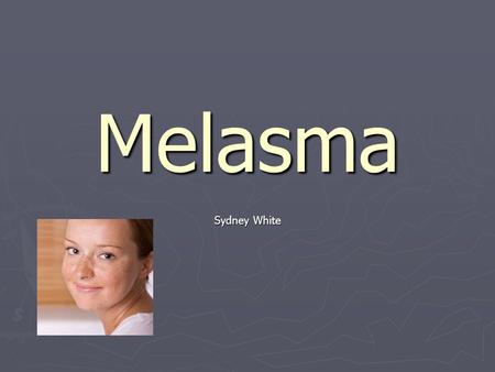 Melasma Sydney White.