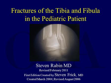 Fractures of the Tibia and Fibula in the Pediatric Patient