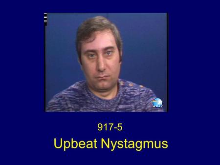 Upbeat Nystagmus 917-5. Eye Movements Upbeat nystagmus in primary gaze Horizontal gaze evoked nystagmus left > right No nystagmus on downgaze Saccadic.