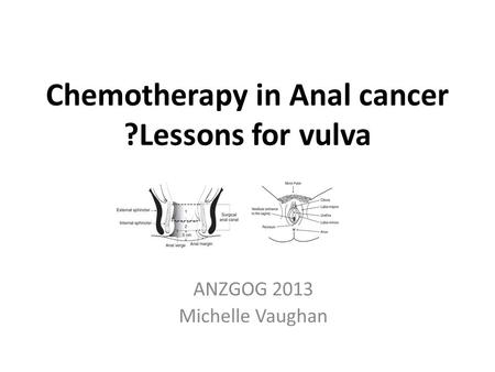 Chemotherapy in Anal cancer ?Lessons for vulva ANZGOG 2013 Michelle Vaughan.