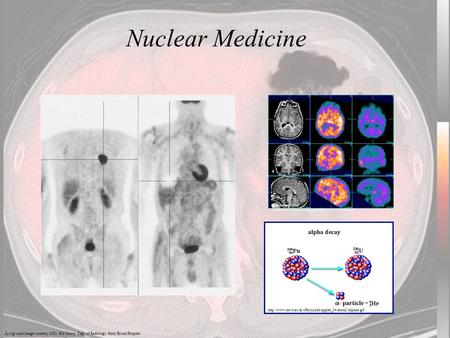 Nuclear Medicine Background Image courtesy of Dr. Bill Moore, Dept. of Radiology, Stony Brook Hospital  studholme.net/research/ipag/mrdspect/mrspect3.html.