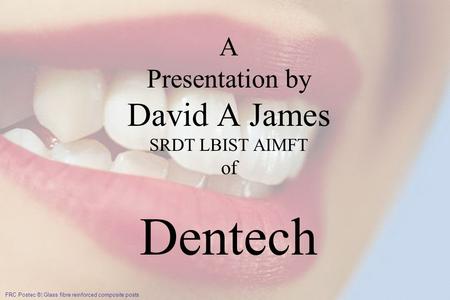 IPS Empress ® System – das Original FRC Postec ®¦ Glass fibre reinforced composite posts A Presentation by David A James SRDT LBIST AIMFT of Dentech Tel/Fax: