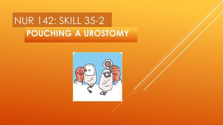 NUR 142: SKILL 35-2 POUCHING A UROSTOMY.