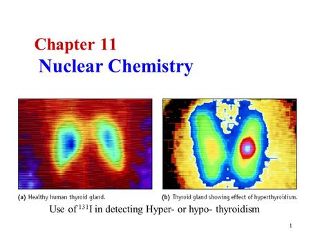 1 Chapter 11 Nuclear Chemistry Use of 131 I in detecting Hyper- or hypo- thyroidism.