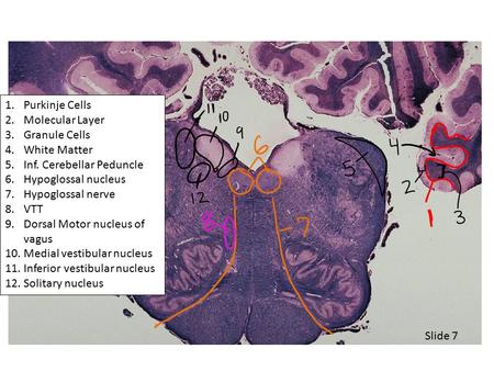 Purkinje Cells Molecular Layer Granule Cells White Matter