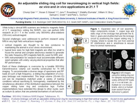 While today’s clinical MRI scanners are limited to magnetic fields of 3 T, researchers visiting the NHMFL now can perform MRI research at 21.1 T in the.