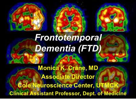 Frontotemporal Dementia (FTD)