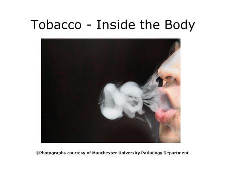 Tobacco - Inside the Body ©Photographs courtesy of Manchester University Pathology Department.