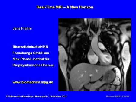 Real-Time MRI – Outline Biomed NMR JF11/59 Technical Considerations - Data Acquisition - Image Reconstruction Preliminary Applications - Joint Movements,