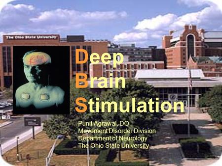 Deep Brain Stimulation