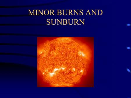 MINOR BURNS AND SUNBURN. Burns Can be caused by thermal, electrical, chemical, or UV radiation exposure More than 80% of burns occur in the home Extent.