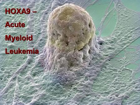 HOXA9 – AcuteMyeloidLeukemia. HOX Genes encode transcription factors